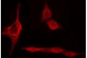 Immunofluorescence (fixed cells) (IF/ICC) image for anti-Proteasome (Prosome, Macropain) 26S Subunit, Non-ATPase, 12 (PSMD12) (Internal Region) antibody (ABIN6257738)