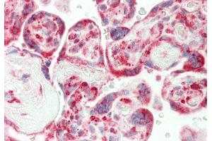 Rabbit Anti-CRIP1 antibody  Formalin Fixed Paraffin Embedded Tissue: Human Placenta Primary antibody Concentration: 1:100 Secondary Antibody: Donkey anti-Rabbit-Cy3 Secondary Antibody Concentration: 1:200 Magnification: 20x Exposure Time: 0. (CRIP1 抗体  (N-Term))