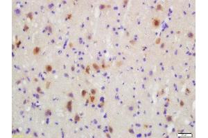 Immunohistochemistry (Paraffin-embedded Sections) (IHC (p)) image for anti-Mitogen-Activated Protein Kinase Kinase 3 (MAP2K3) (pSer207) antibody (ABIN2177687)