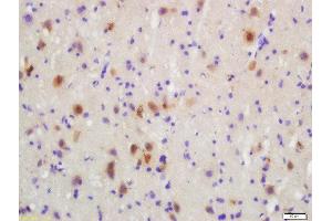 Formalin-fixed and paraffin embedded rat brain labeled with Rabbit Anti-MKK3(Ser218)/MKK6(Ser207) Polyclonal Antibody, Unconjugated  at 1:200 followed by conjugation to the secondary antibody and DAB staining (MAP2K3 抗体  (pSer207))