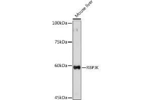 Western Blotting (WB) image for anti-Recombination Signal Binding Protein For Immunoglobulin kappa J Region (RBPJ) (AA 1-260) antibody (ABIN6146805)