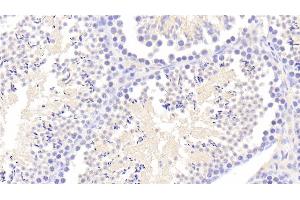 Immunohistochemistry (IHC) image for anti-Tryptase beta 2 (TPSB2) (AA 30-276) antibody (ABIN7443440)