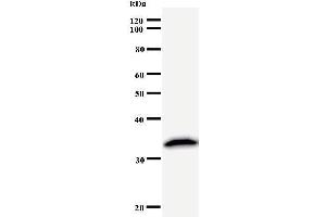 Western Blotting (WB) image for anti-PRP8 Pre-mRNA Processing Factor 8 (PRPF8) antibody (ABIN933118) (PRPF8 抗体)