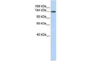 Western Blotting (WB) image for anti-ATPase, Class VI, Type 11B (ATP11B) (N-Term) antibody (ABIN2782823)