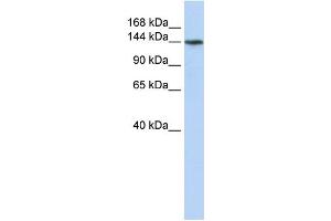 WB Suggested Anti-ATP11B Antibody Titration:  0. (ATP11B 抗体  (N-Term))