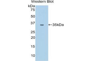 Western blot analysis of the recombinant protein. (CEACAM1 抗体  (AA 35-320))