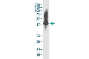 Western Blotting (WB) image for anti-KIAA1191 (KIAA1191) (AA 1-305) antibody (ABIN2752284)