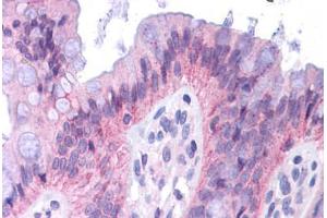 Human Colon: Formalin-Fixed, Paraffin-Embedded (FFPE) (CEBPA 抗体  (AA 288-337))