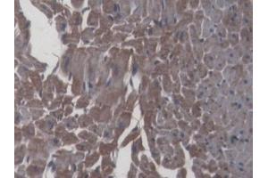 Detection of IL6 in Rat Cardiac Muscle Tissue using Monoclonal Antibody to Interleukin 6 (IL6) (IL-6 抗体  (AA 25-211))