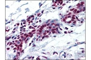 Human Breast: Formalin-Fixed, Paraffin-Embedded (FFPE) (MYB 抗体  (N-Term))