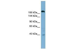 ABCC11 antibody used at 1 ug/ml to detect target protein. (ABCC11 抗体)