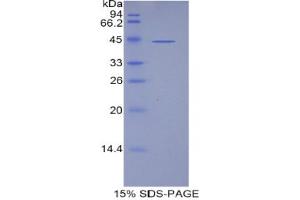 SDS-PAGE analysis of Human Lipocalin 15 Protein. (LCN15 蛋白)