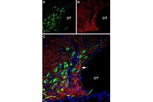 Multiplex staining of AT2 receptor and VGLUT2 in rat supraoptic hypothalamic nucleus - Immunohistochemical staining of perfusion-fixed frozen rat brain sections using Anti-Angiotensin II Receptor Type-2 (extracellular)-ATTO Fluor-488 Antibody (ABIN7042926), (1:60) and Anti-VGLUT2-ATTO Fluor-594 Antibody (ABIN7043682), (1:60). (Angiotensin II Type 2 Receptor 抗体  (Extracellular, N-Term) (Atto 488))
