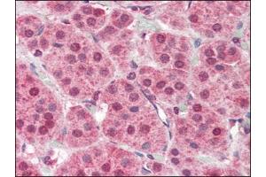 Human Adrenal (formalin-fixed, paraffin-embedded) stained with PARP2at 2. (PARP2 抗体  (Internal Region))