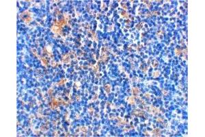 Immunohistochemistry (IHC) image for anti-BCL2-Associated Agonist of Cell Death (BAD) (C-Term) antibody (ABIN1030278) (BAD 抗体  (C-Term))