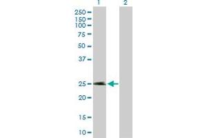 Western Blot analysis of NECAB2 expression in transfected 293T cell line by NECAB2 MaxPab polyclonal antibody. (NECAB2 抗体  (AA 1-239))