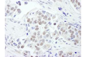 Immunohistochemistry (IHC) image for anti-GATA Binding Protein 3 (GATA3) (AA 150-200) antibody (ABIN7454559) (GATA3 抗体  (AA 150-200))