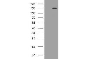 Image no. 1 for anti-Fibroblast Growth Factor Receptor 3 (FGFR3) (AA 23-375) antibody (ABIN1491237) (FGFR3 抗体  (AA 23-375))