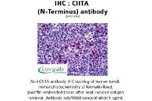 Image no. 1 for anti-Class II, Major Histocompatibility Complex, Transactivator (CIITA) (N-Term) antibody (ABIN1733098) (CIITA 抗体  (N-Term))