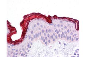 DBT antibody was used for immunohistochemistry at a concentration of 4-8 ug/ml. (DBT 抗体  (N-Term))