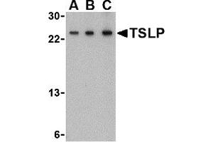 Western Blotting (WB) image for anti-Thymic Stromal Lymphopoietin (TSLP) (Middle Region) antibody (ABIN1031147) (Thymic Stromal Lymphopoietin 抗体  (Middle Region))