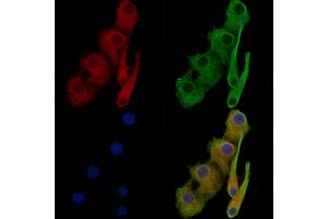 ABIN7093772 and ABIN7097813 staining Hela cells by IF/ICC.