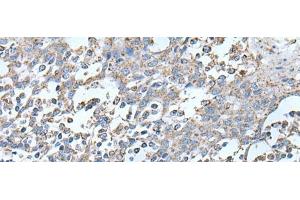 Immunohistochemistry of paraffin-embedded Human tonsil tissue using IRF5 Polyclonal Antibody at dilution of 1:25(x200) (IRF5 抗体)