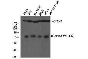 Western Blotting (WB) image for anti-Notch 4 (NOTCH4) (cleaved), (Val1432) antibody (ABIN3172780) (NOTCH4 抗体  (cleaved, Val1432))