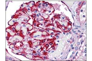 Human Kidney: Formalin-Fixed, Paraffin-Embedded (FFPE) (FREM2 抗体)