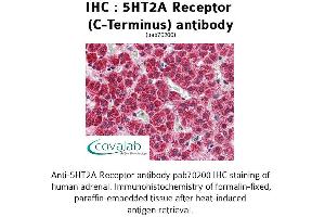Image no. 1 for anti-5-Hydroxytryptamine (serotonin) Receptor 2A (HTR2A) (C-Term) antibody (ABIN1731361) (HTR2A 抗体  (C-Term))