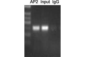 ChIP analysis of Cervical cancer cell lines lysate, incubated for 12 hours at 4°C. (AP2 alpha/beta (C-Term) 抗体)