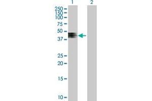 Western Blot analysis of ZNRF4 expression in transfected 293T cell line by ZNRF4 MaxPab polyclonal antibody. (ZNRF4 抗体  (AA 1-429))