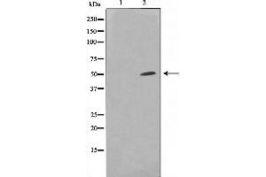 Western blot analysis on HuvEc cell lysate using SUPT3H Antibody,The lane on the left is treated with the antigen-specific peptide. (SUPT3H/SPT3 抗体  (Internal Region))