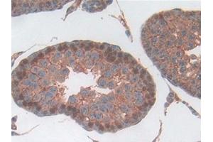 Immunohistochemistry (IHC) image for anti-Haptoglobin (HP) (AA 104-346) antibody (ABIN7443863)