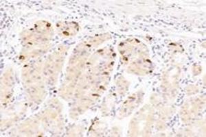 Immunohistochemistry analysis of paraffin-embedded human stomach using,Epsin-3 (ABIN7073856) at dilution of 1: 4400 (EPN3 抗体)