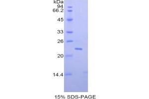 SDS-PAGE of Protein Standard from the Kit (Highly purified E. (PON1 ELISA 试剂盒)