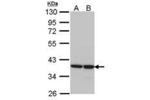 Image no. 1 for anti-Aldo-Keto Reductase Family 1, Member B1 (Aldose Reductase) (AKR1B1) (AA 1-298) antibody (ABIN467605) (AKR1B1 抗体  (AA 1-298))