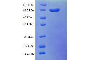 SDS-PAGE (SDS) image for RAD23 Homolog A (RAD23A) (AA 1-363), (full length) protein (GST tag) (ABIN5710213) (RAD23A Protein (AA 1-363, full length) (GST tag))
