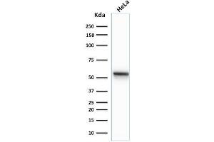 Western Blot Analysis of human HeLa cell lysate using Cytokeratin 7 Mouse Monoclonal Antibody (K72.