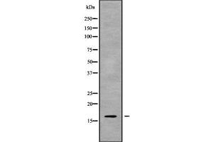 Western blot analysis of CST8 using Jurkat whole cell lysates (CST8 抗体  (Internal Region))