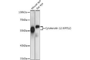 Western blot analysis of extracts of various cell lines, using Cytokeratin 12 (Cytokeratin 12 (KRT12)) antibody (ABIN7268088) at 1:1000 dilution. (KRT12 抗体  (AA 295-494))
