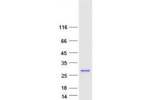 Validation with Western Blot