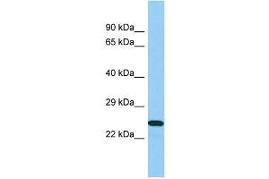 Host: Rabbit Target Name: B9D1 Sample Type: 721_B Whole Cell lysates Antibody Dilution: 1. (B9D1 抗体  (N-Term))