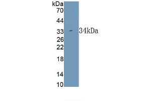 Detection of Recombinant CTGF, Rabbit using Polyclonal Antibody to Connective Tissue Growth Factor (CTGF) (CTGF 抗体  (AA 118-388))
