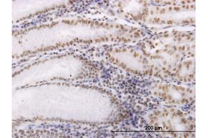 Immunoperoxidase of monoclonal antibody to OXSR1 on formalin-fixed paraffin-embedded human stomach. (OXSR1 抗体  (AA 351-450))