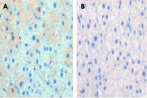 Formalin-fixed and paraffin-embedded cow lactatingreacted with CPT1A polyclonal antibody , which was peroxidase-conjugated to the secondary antibody, followed by AEC staining. (CPT1A 抗体  (C-Term))