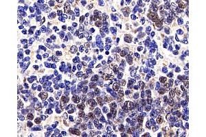 Immunohistochemistry analysis of paraffin-embedded Rat spleen cancer using p27 Polyclonal Antibody at dilution of 1:200. (P27 抗体)