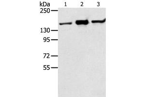 Western Blot analysis of Jurkat, K562 and hela cell using STAG2 Polyclonal Antibody at dilution of 1:350 (STAG2 抗体)