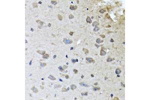 Immunohistochemistry of paraffin-embedded mouse brain using BRCA1 antibody (ABIN5970045) at dilution of 1/100 (40x lens). (BRCA1 抗体)
