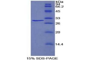 SDS-PAGE analysis of Rat TRADD Protein. (TRADD 蛋白)